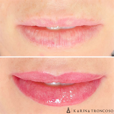 Nanopigmentação Labial